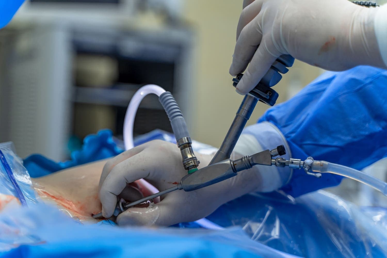 Pelvic Reconstruction