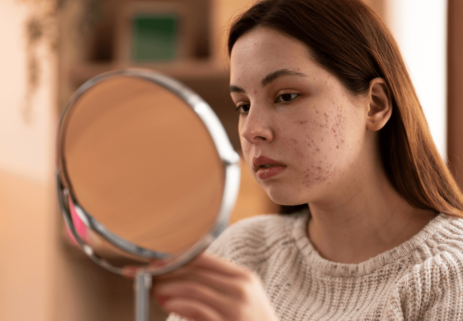Woman with acne looking in the mirror with a somber facial expression.