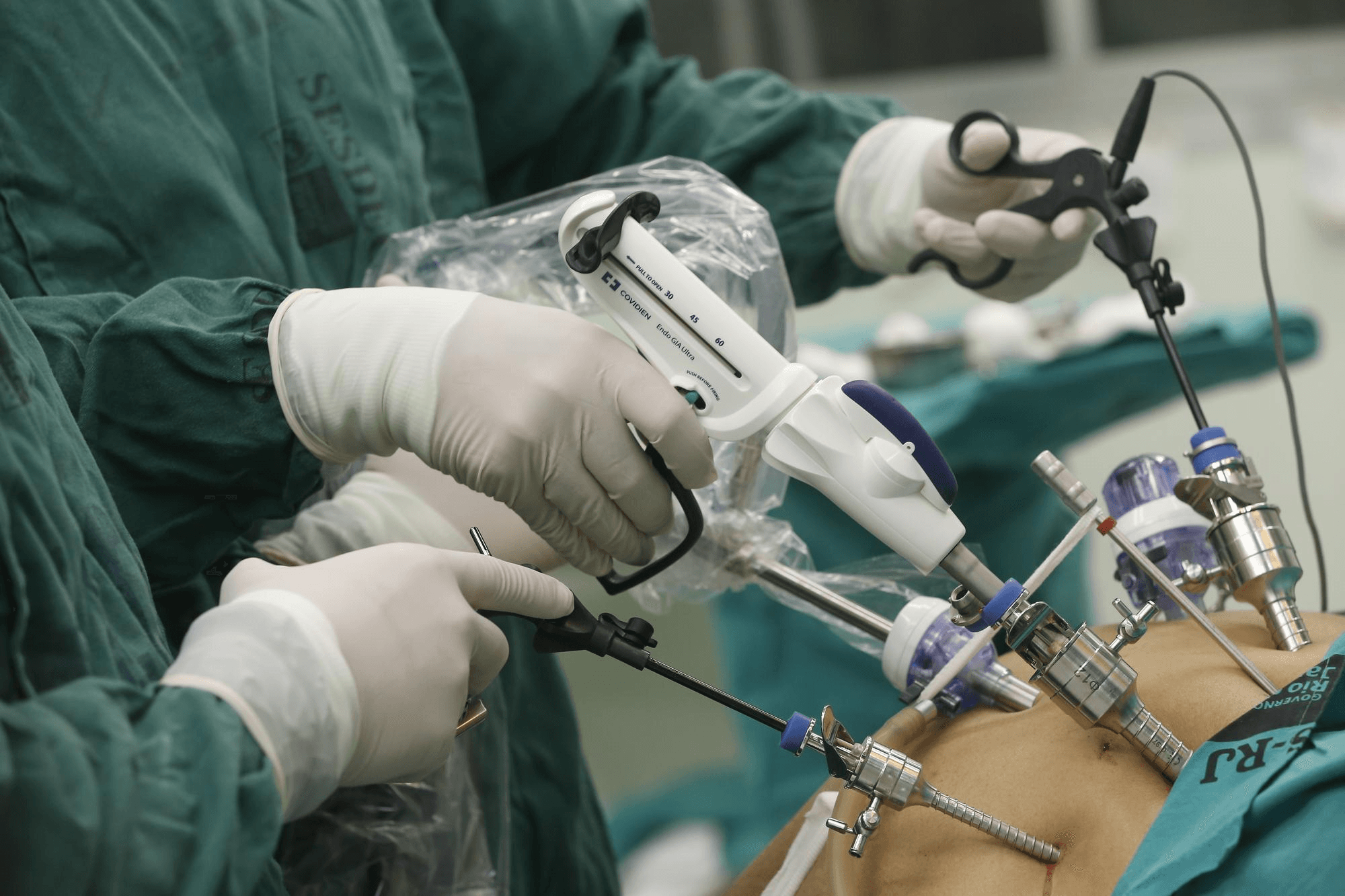 Minimal invasive surgery procedure in a state-of-the-art facility: surgeon applies new methods and tools for better patient results in a modern medical environment.