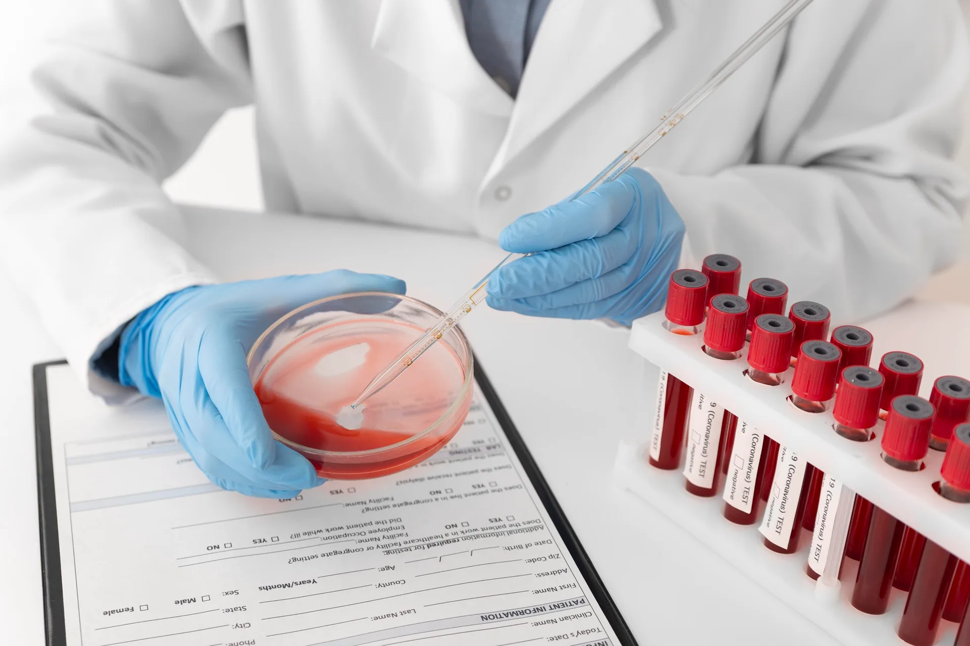 AB Positive Blood Type: Universal Recipient for Red Cells, Universal Plasma Donor