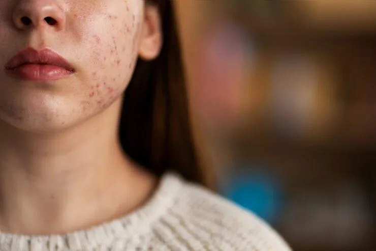 Pregnancy Skin Changes: What Causes Them, What's Normal, and What Fades